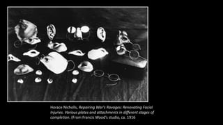 Horace Nicholls, Repairing War's Ravages: Renovating Facial
Injuries. Various plates and attachments in different stages of
completion. (From Francis Wood’s studio, ca. 1916
 