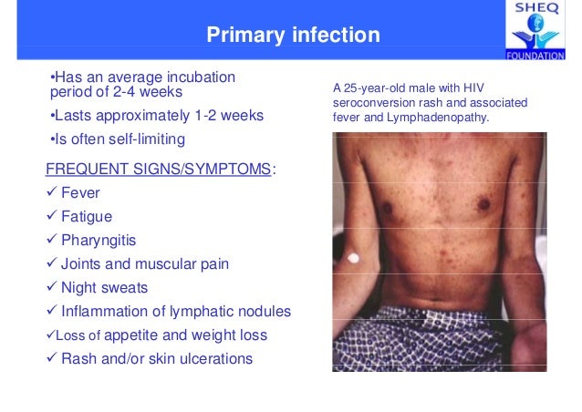 Acute Seroconversion Rash Hiv Seroconversion Symptoms , HIV Seroconversion: Testing, Treatment ...