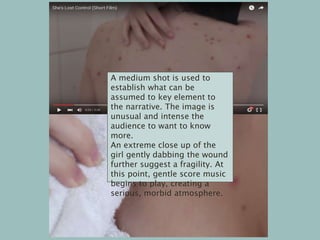 A medium shot is used to
establish what can be
assumed to key element to
the narrative. The image is
unusual and intense the
audience to want to know
more.
An extreme close up of the
girl gently dabbing the wound
further suggest a fragility. At
this point, gentle score music
begins to play, creating a
serious, morbid atmosphere.
 
