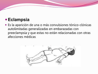  Eclampsia
 Es la aparición de una o más convulsiones tónico-clónicas
autolimitadas generalizadas en embarazadas con
preeclampsia y que estas no están relacionadas con otras
afecciones médicas
 