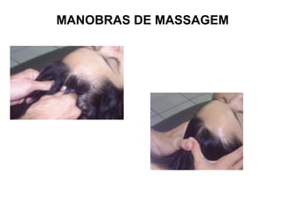 MANOBRAS DE MASSAGEM
 