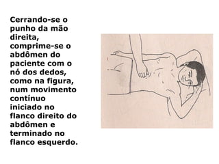 Cerrando-se o
punho da mão
direita,
comprime-se o
abdômen do
paciente com o
nó dos dedos,
como na figura,
num movimento
contínuo
iniciado no
flanco direito do
abdômen e
terminado no
flanco esquerdo.
 