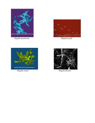 Shigella dysenteriae Shigella boydii
Shigella sonnei Shigella flexneri
 