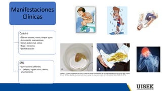 Manifestaciones
Clínicas
Cuadro
• Diarrea acuosa, moco, sangre y pus.
• Incremento evacuaciones
• Dolor abdominal, cólico
• Pujo y tenesmo.
• Deshidratación
SNC
• Convulsiones (febriles)
• Cefalea, rigidez nuca, delirio,
alucinaciones.
 