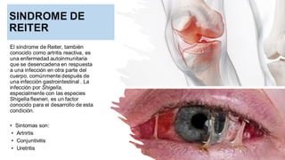 El síndrome de Reiter, también
conocido como artritis reactiva, es
una enfermedad autoinmunitaria
que se desencadena en respuesta
a una infección en otra parte del
cuerpo, comúnmente después de
una infección gastrointestinal . La
infección por Shigella,
especialmente con las especies
Shigella flexneri, es un factor
conocido para el desarrollo de esta
condición.
• Sintomas son:
• Artrirtis
• Conjuntivitis
• Uretritis
 