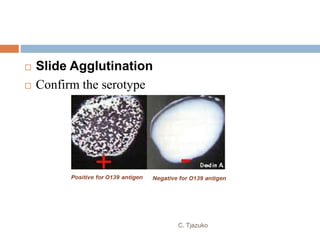  Slide Agglutination
 Confirm the serotype
C. Tjazuko
 