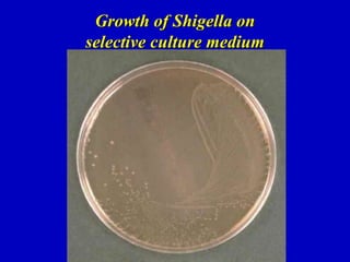 Growth of Shigella on
selective culture medium
 