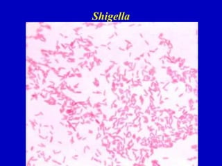 Shigella
 