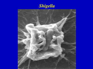 Shigella
 