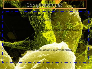 ComplicacionesComplicaciones
• Shigella dysenteriae
– Síndrome hemolítico urémico
– Síndrome de Eriki
• Megacolon tóxico, perforación, encefalopatía tóxica
• Shigella flexneri
– Síndrome de Reiter
• Uretritis, artritis, conjuntivitis, queratodermia
 