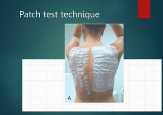 Patch test technique
 