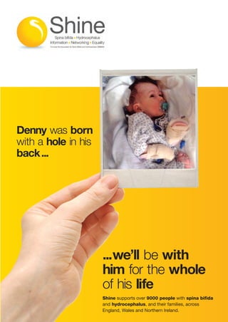 Shine_8ppA4_AW_Aug12Rev2_Layout 1 06/12/2012 17:29 Page 2

Denny was born
with a hole in his
back...

...we’ll be with
him for the whole
of his life
Shine supports over 9000 people with spina bifida
and hydrocephalus, and their families, across
England, Wales and Northern Ireland.

 