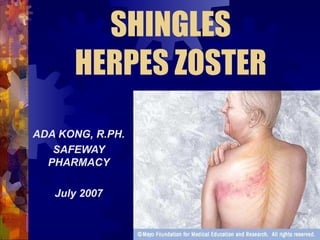 SHINGLES
      HERPES ZOSTER
ADA KONG, R.PH.
   SAFEWAY
  PHARMACY

   July 2007
 