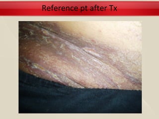 Reference pt after Tx
 