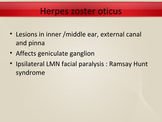 Herpes zoster oticus

• Lesions in inner /middle ear, external canal
  and pinna
• Affects geniculate ganglion
• Ipsilateral LMN facial paralysis : Ramsay Hunt
  syndrome
 