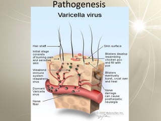 Pathogenesis
 