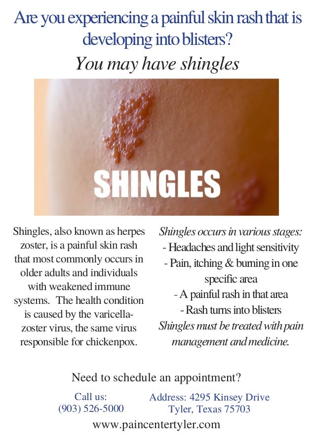 Shingles Pain Management Tyler TX