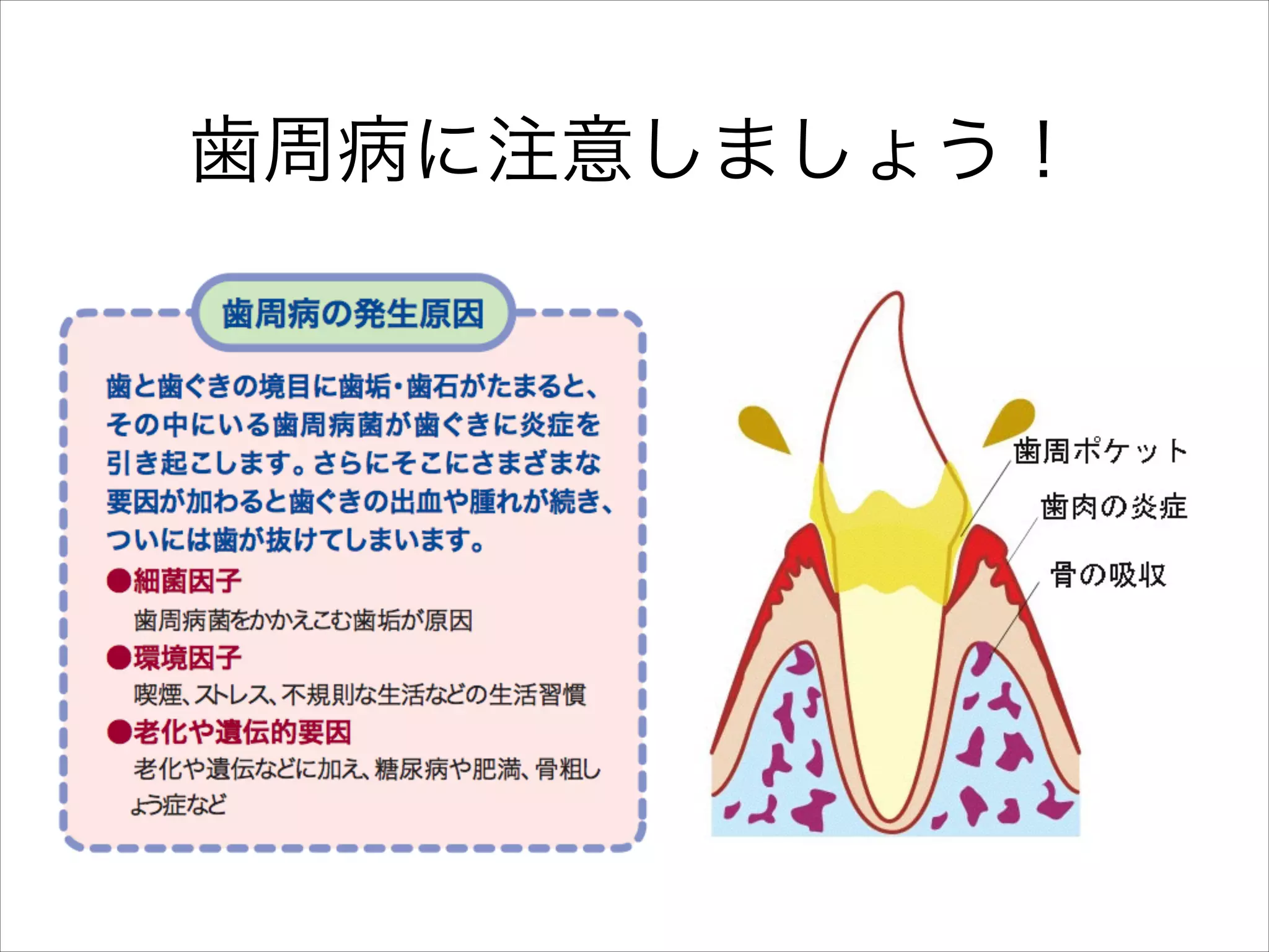 歯周病に注意しましょう！

 