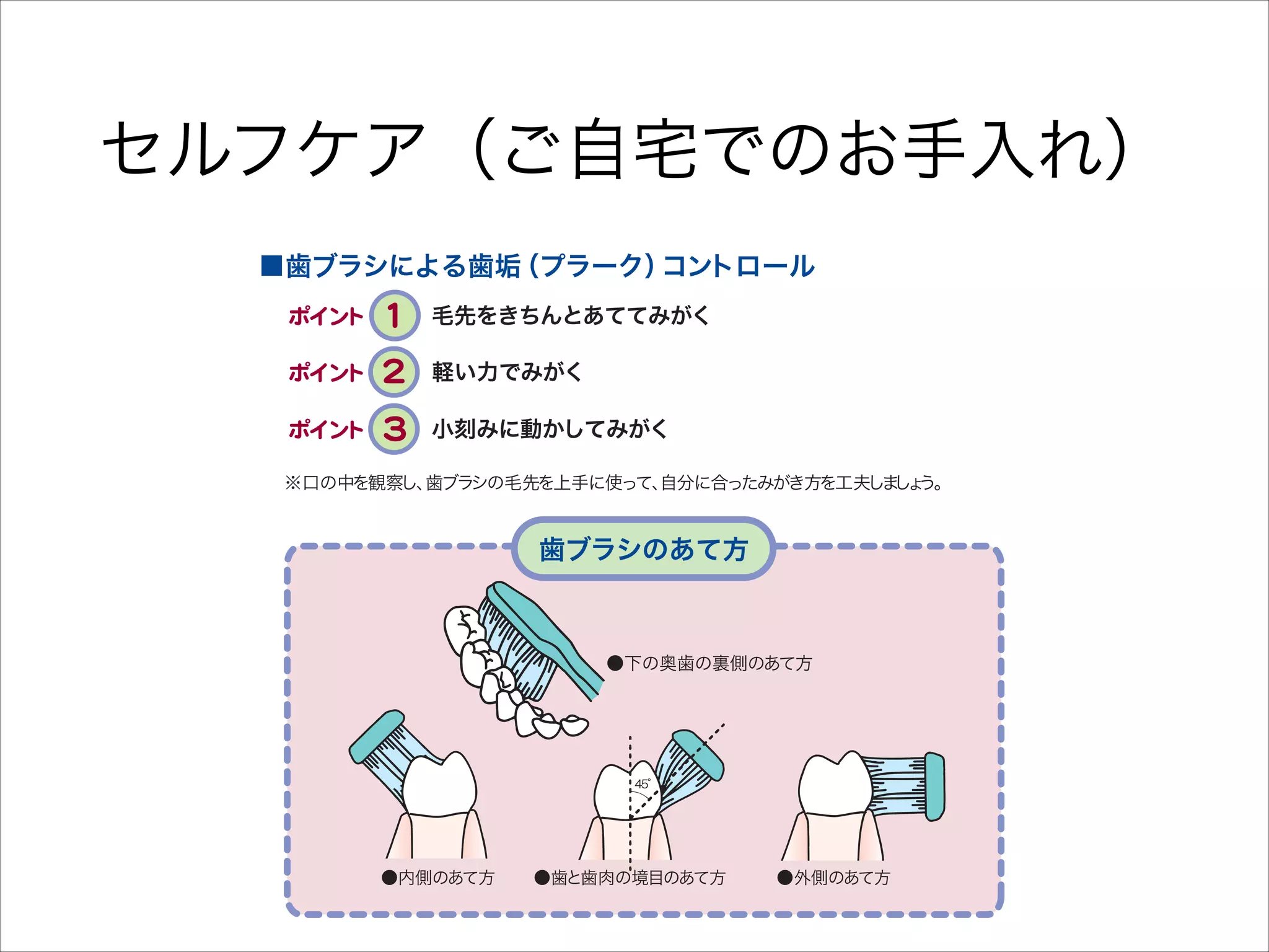 ■舌の清掃
 口腔清掃には、 ッ ング以外にもいくつかの方法があ ます。
ブラ シ
り
歯だけでな
く舌や

セルフケア（ご自宅でのお手入れ）
口腔粘膜も含め、
ていねいにすみずみまでしっかり清掃しま ょ 効果的な清掃の
し う。

方法や清掃器具の選択については、
気軽に歯科医師 歯科衛生士にたずねま ょ
・
し う。

■歯ブラシによる歯垢
（プラーク）
コントロール
毛先をきちんとあててみがく
軽い力でみがく
小刻みに動かしてみがく
※口の中を観察し、
歯ブラ
シの毛先を上手に使って、
自分に合ったみがき方を工夫し し う。
ま ょ

歯ブラシのあて方

●下の奥歯の裏側のあて方

45°

●内側のあて方

●歯と歯肉の境目のあて方

●外側のあて方

舌のケアは、
口臭
舌の清掃は、
忘れ
のに有効なケアで

■洗口剤によ

 