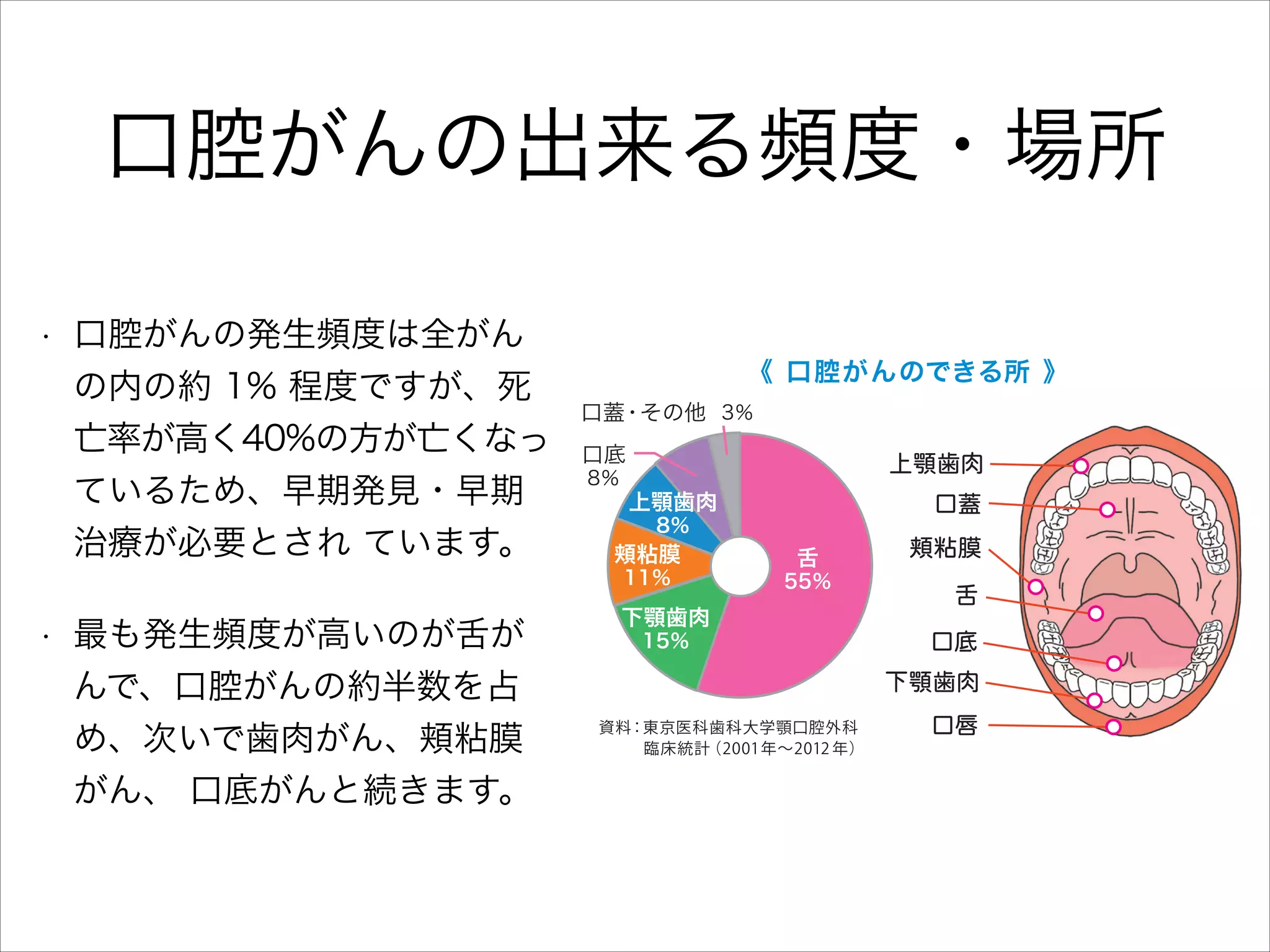 口腔がんの出来る頻度・場所
腔がん

は、
死亡率の高いがんです

• 口腔がんの発生頻度は全がん
ける口腔・咽 頭 が んの年間 罹 患 患 者 数
には 2,500 人程度でしたが、
2006 年に
の内の約 1% 程度ですが、死
を超え、
2015年には 15,000人を超える
亡率が高く40%の方が亡くなっ
されています。
口腔がんの発生頻度は全
1% 程度ですが、
口腔がんは高齢者に多
ているため、早期発見・早期
では人口の高齢化に伴い今後も増加する
治療が必要とされ ています。
ています。
率が高く、
40％の方が亡くなっている事
• 最も発生頻度が高いのが舌が
一層の早期発見・早期治療が必要とされ
口腔がん罹患の男女比は、
およそ３
：2 と
んで、口腔がんの約半数を占
、
好発年齢は 60 歳代です。

め、次いで歯肉がん、頬粘膜
がん、 口底がんと続きます。

がんの約半数を占め、次いで歯肉がん、頬粘膜がん、
口底がんと続きます。がんの恐ろしいところは、違う
場所へ飛び火
（転移）
を起こすことです。口腔がんでは、
首のリンパ節（頸部リンパ節）に最も高い確率で転移
を起こします。
《 口腔がんのできる所 》

口蓋・その他 3％
口底
8％

上顎歯肉 
上顎歯肉
8％

頬粘膜
11％

下顎歯肉

口蓋 
舌

55％

15％

頬粘膜
舌
口底
下顎歯肉

資料：東京医科歯科大学顎口腔外科
    臨床統計
（2001年∼2012 年）

口唇

《 口腔がん症例写真 》

 