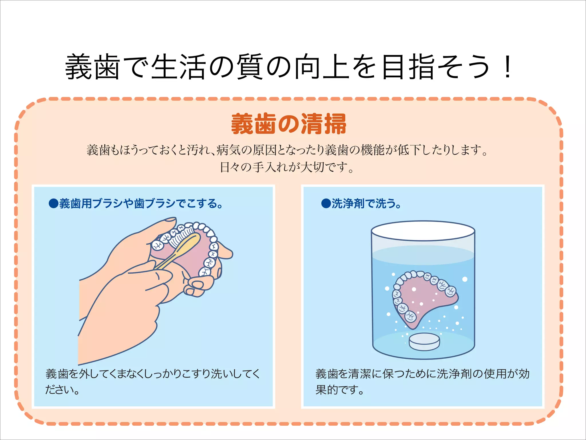 ケア開始前の食事 ・
〈粥 刻み食〉

ケア開始後の食事
〈常食〉

義歯で生活の質の向上を目指そう！
出典 EBMに基づいた口腔ケアのために 医歯薬出版株式会社
：

義歯もほ ってお と汚れ、
う
く
病気の原因と
なった
り義歯の機能が低下した します。
り
日々の手入れが大切です。
●義歯用ブラシや歯ブラシでこする。

義歯を外して まな しっかり
く く
こすり洗い
して
く
だ い。
さ

●洗浄剤で洗う。

義歯を清潔に保つために洗浄剤の使用が効
果的です。

 