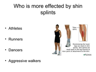 Who is more effected by shin splints Athletes Runners Dancers Aggressive walkers