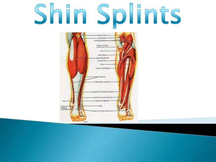 Shin splints powerpoint