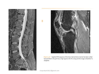 MRI spin echo pulse sequences | PPTX