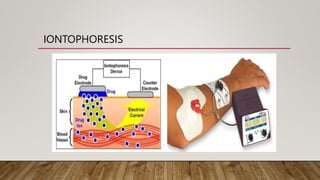 IONTOPHORESIS
 