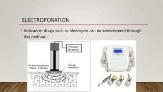 ELECTROPORATION
• Anticancer drugs such as bleomycin can be administered through
this method .
 