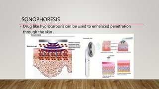 SONOPHORESIS
• Drug like hydrocarbons can be used to enhanced penetration
through the skin .
 