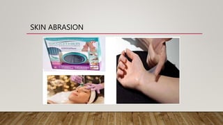 SKIN ABRASION
 
