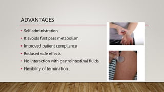 ADVANTAGES
• Self administration
• It avoids first pass metabolism
• Improved patient compliance
• Redused side effects
• No interaction with gastrointestinal fluids
• Flexibility of termination .
 