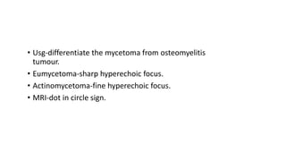 • Usg-differentiate the mycetoma from osteomyelitis
tumour.
• Eumycetoma-sharp hyperechoic focus.
• Actinomycetoma-fine hyperechoic focus.
• MRI-dot in circle sign.
 