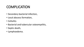 COMPLICATION
• Secondary bacterial infection,
• Local abscess formation,
• Cellulitis
• Bacterial and tubercular osteomyelitis,
• Septic death,
• Lymphoedema.
 