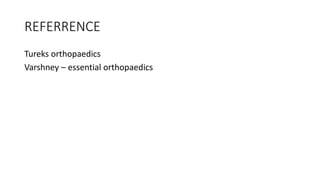 REFERRENCE
Tureks orthopaedics
Varshney – essential orthopaedics
 