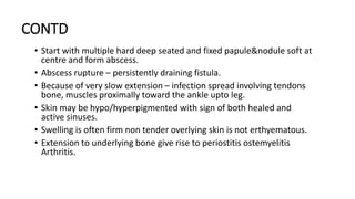 CONTD
• Start with multiple hard deep seated and fixed papule&nodule soft at
centre and form abscess.
• Abscess rupture – persistently draining fistula.
• Because of very slow extension – infection spread involving tendons
bone, muscles proximally toward the ankle upto leg.
• Skin may be hypo/hyperpigmented with sign of both healed and
active sinuses.
• Swelling is often firm non tender overlying skin is not erthyematous.
• Extension to underlying bone give rise to periostitis ostemyelitis
Arthritis.
 