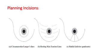 oncoplasty breast | PPT