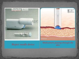 Bioject Needle Less Injection Technology by S Shivani Shastrulagari. | PPTX