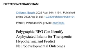 ELECTROENCEPHALOGRAM
 