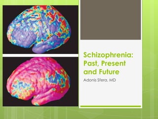 Schizophrenia:
Past, Present
and Future
Adonis Sfera, MD
 