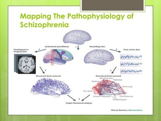 Mapping The Pathophysiology of
Schizophrenia
 