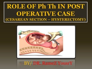 ROLE OF Ph Th IN POST
OPERATIVE CASE
(CESAREAN SECTION – HYSTERECTOMY)
BY/ DR. RameZ YousrY
 