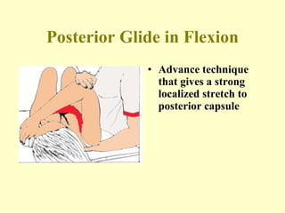 Posterior Glide in Flexion Advance technique that gives a strong   localized stretch to posterior capsule 
