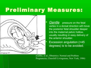 Preliminary Measures:

                   Gentle        pressure on the fetal
                     vertex in a dorsal direction will move
                     the posterior fetal shoulder deeper
                     into the maternal pelvic hollow,
                     usually resulting in easy delivery of
                     the anterior shoulder.
                   Excession angulation (>45
                    degrees) is to be avoided.


        (Gabbe, et al., Obstetrics: Normal and Problem
        Pregnancies, Churchill Livingstone, New York, 1986)
 