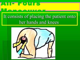 All- Fours
Manoeuver
It consists of placing the patient onto
         her hands and knees
 