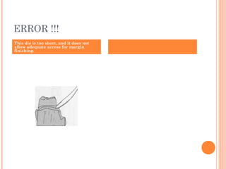 ERROR !!!
This die is too short, and it does not
allow adequate access for margin
finishing.
 