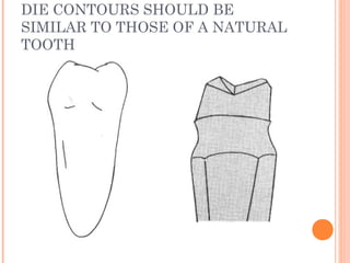 DIE CONTOURS SHOULD BE
SIMILAR TO THOSE OF A NATURAL
TOOTH
 