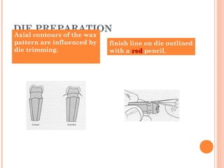 DIE PREPARATION
Axial contours of the wax
pattern are influenced by
die trimming.
finish line on die outlined
with a redred pencil.
 