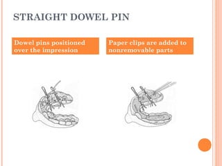 STRAIGHT DOWEL PIN
Dowel pins positioned
over the impression
Paper clips are added to
nonremovable parts
 